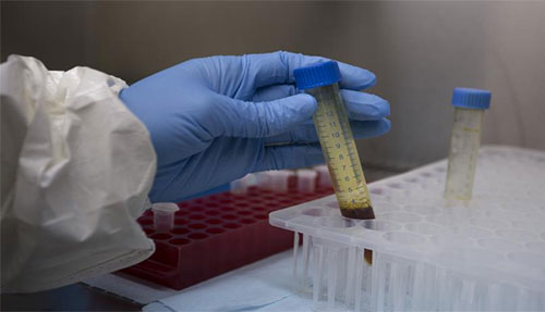 Boosting Immunity Using Homeopathy